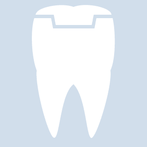 Onlay Abbildung eines Onlay